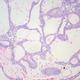 Illustration for article titled FDA Approves Prostate Cancer Vaccine